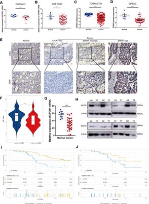 EPDR1, Which Is Negatively Regulated by miR-429, Suppresses Epithelial Ovarian Cancer Progression via PI3K/AKT Signaling Pathway